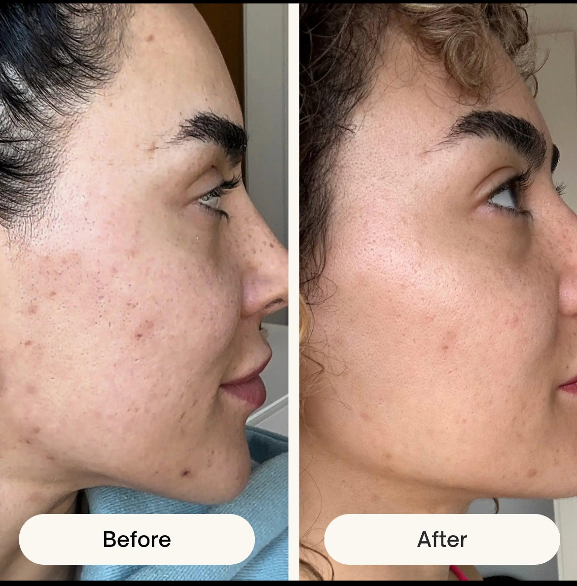 ✨ Gant Exfoliant en Soie VISAGE
