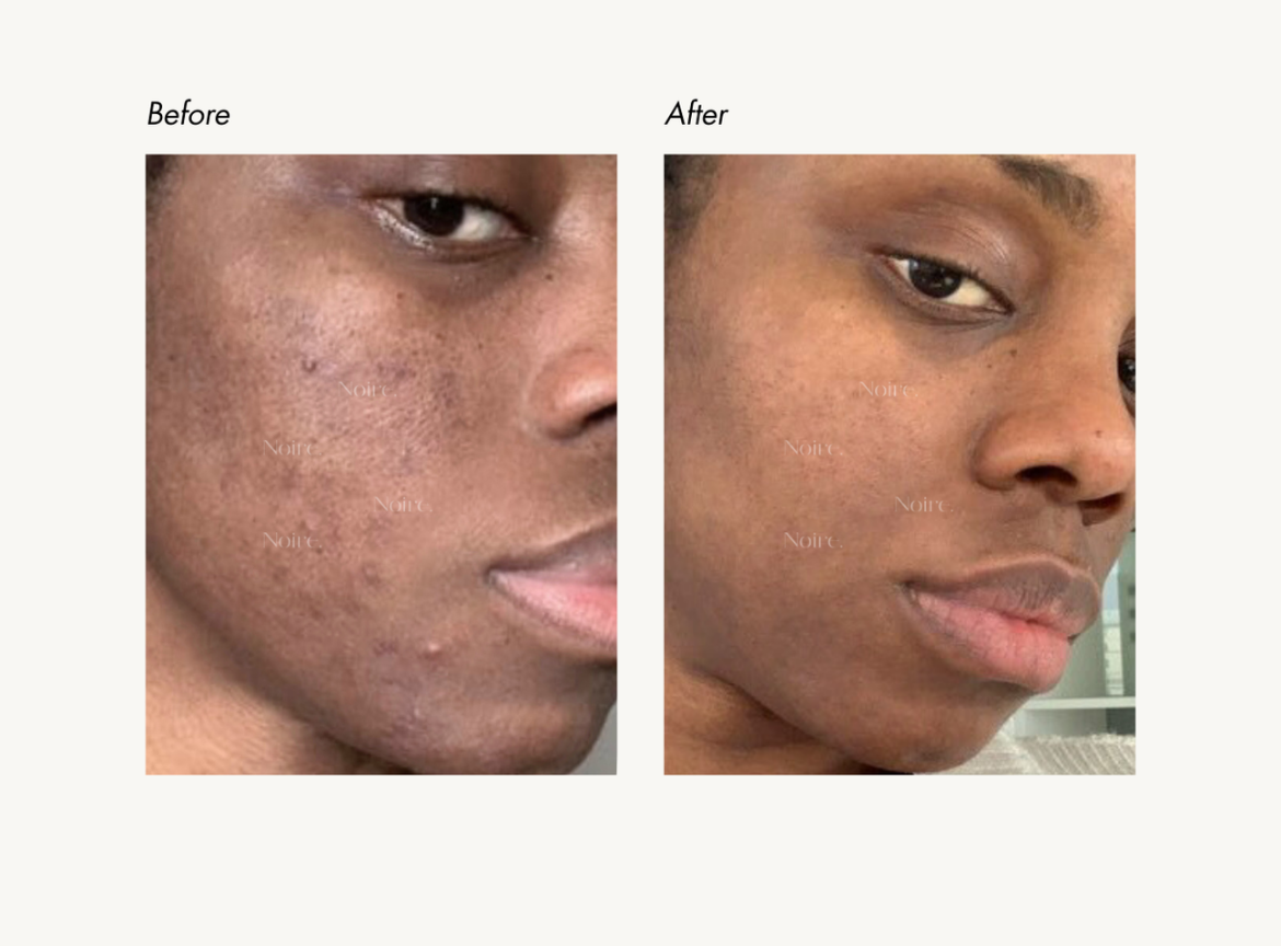 ✨ Gant Exfoliant en Soie VISAGE